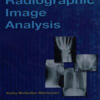 Full Download Test Bank Radiographic Image Analysis 3 by Kathy McQuillen-Martensen MA RT(R)