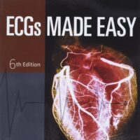 Full Download Manual Solution ECGs Made Easy 6 by Barbara J Aehlert MSEd BSPA RN