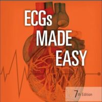 Full Download Manual Solution ECGs Made Easy 7 by Barbara J Aehlert MSEd BSPA RN